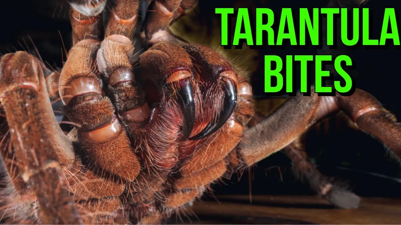 24251 first aid tarantula bite